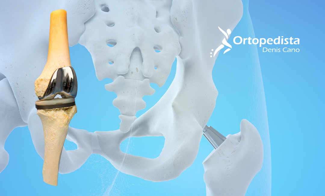 Infecciones de prótesis articulares: innovaciones y nuevas pautas que marcan la diferencia en 2025