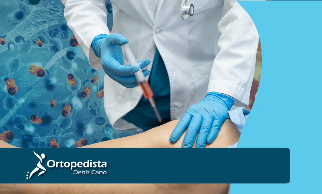 Tratamiento con Células Madre en Medellín: Innovación y Beneficios para la Salud Articular