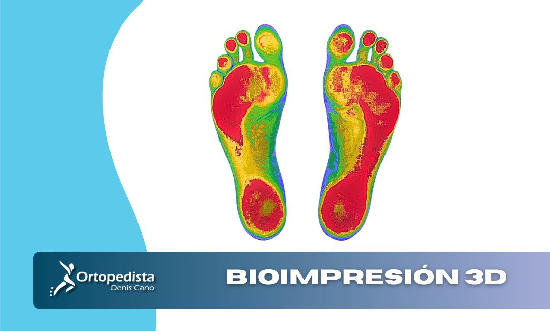 Bioimpresión 3D: Una nueva esperanza para el tratamiento del pie diabético