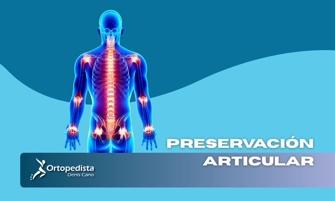 ¿Reparar o Reemplazar? La Revolución de la Preservación Articular en 2026